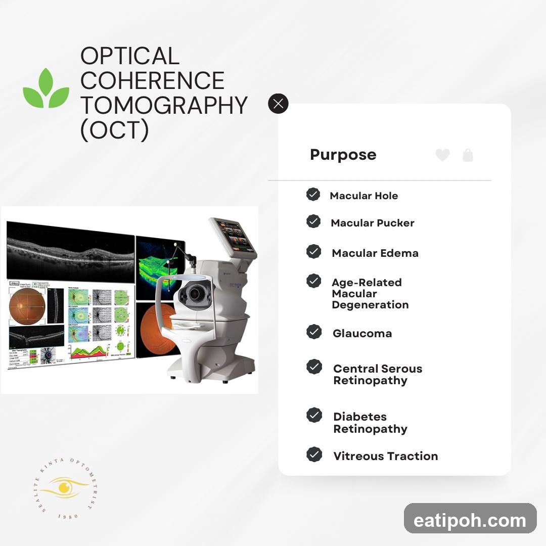 Optical Coherence Tomography (OCT) Information