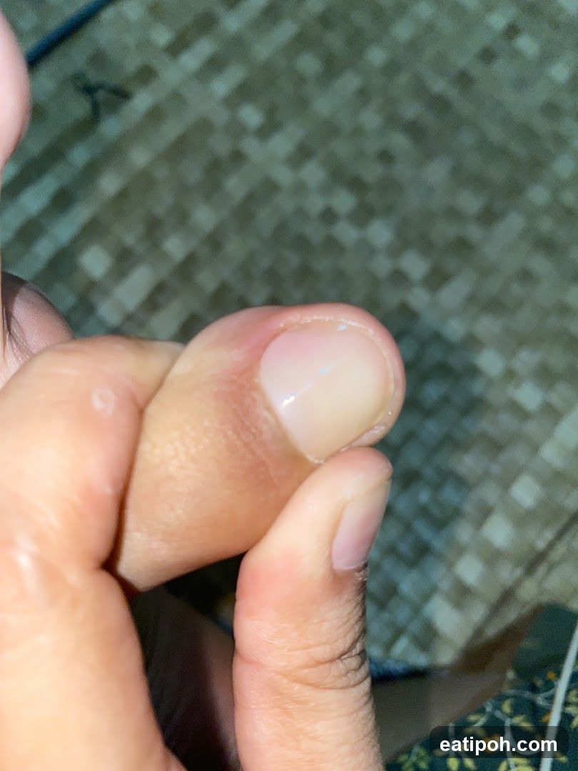 Close-up of a fingernail