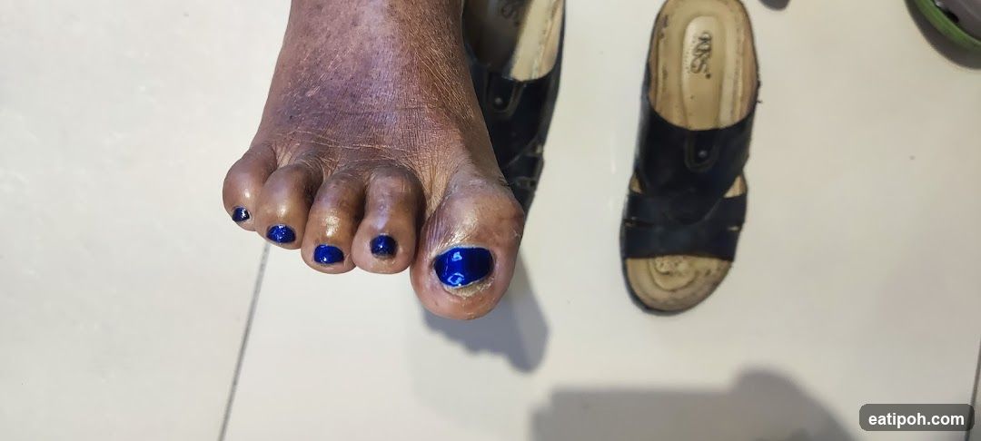 Toes with Blue Nail Polish and Sandals